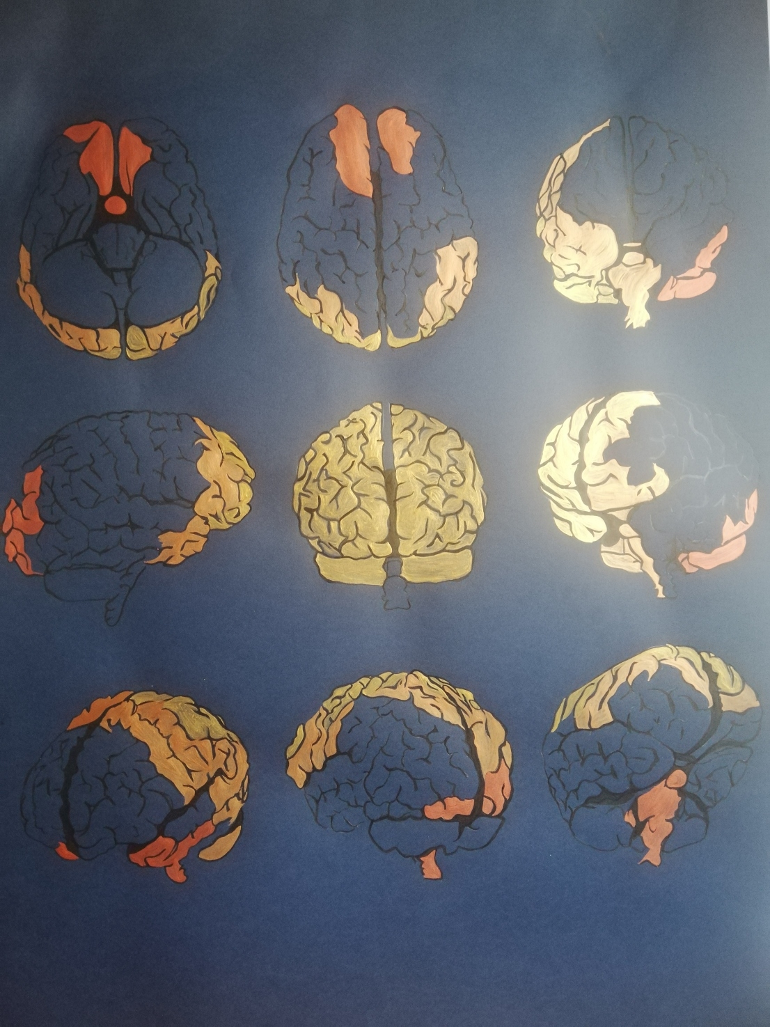 Cerebros. Acrílico sobre papel. 70 x 100 cm. 2022